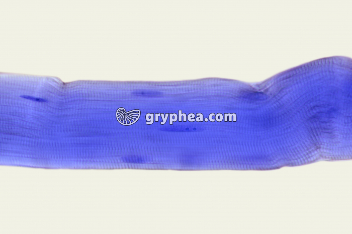 Fibre musculaire x200 - gryphea.com